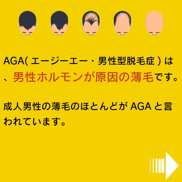 AGAは男性ホルモンが原因の薄毛